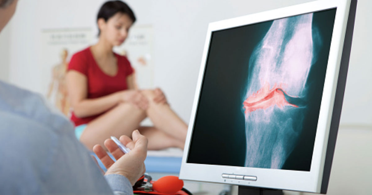 Can hip strengthening exercises help with knee osteoarthritis?
