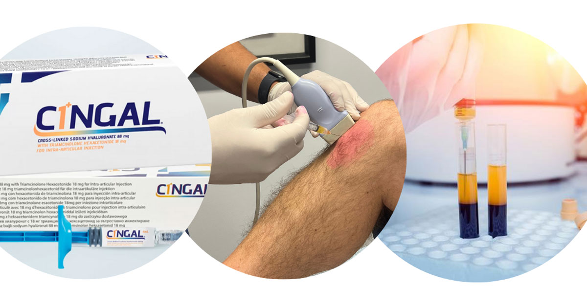 Intra-articular injections commonly include corticosteroids, hyaluronic acid (viscosupplementation), or newer biologics including PRP. Understanding relative efficacy, durability, and safety is key to choosing among them. 